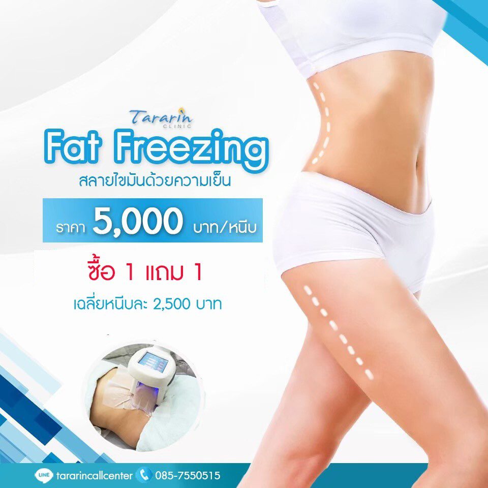 Fat Freezing 1 แถม 1 ลดไขมัน ง่าย ๆ ไม่ต้องผ่าตัด