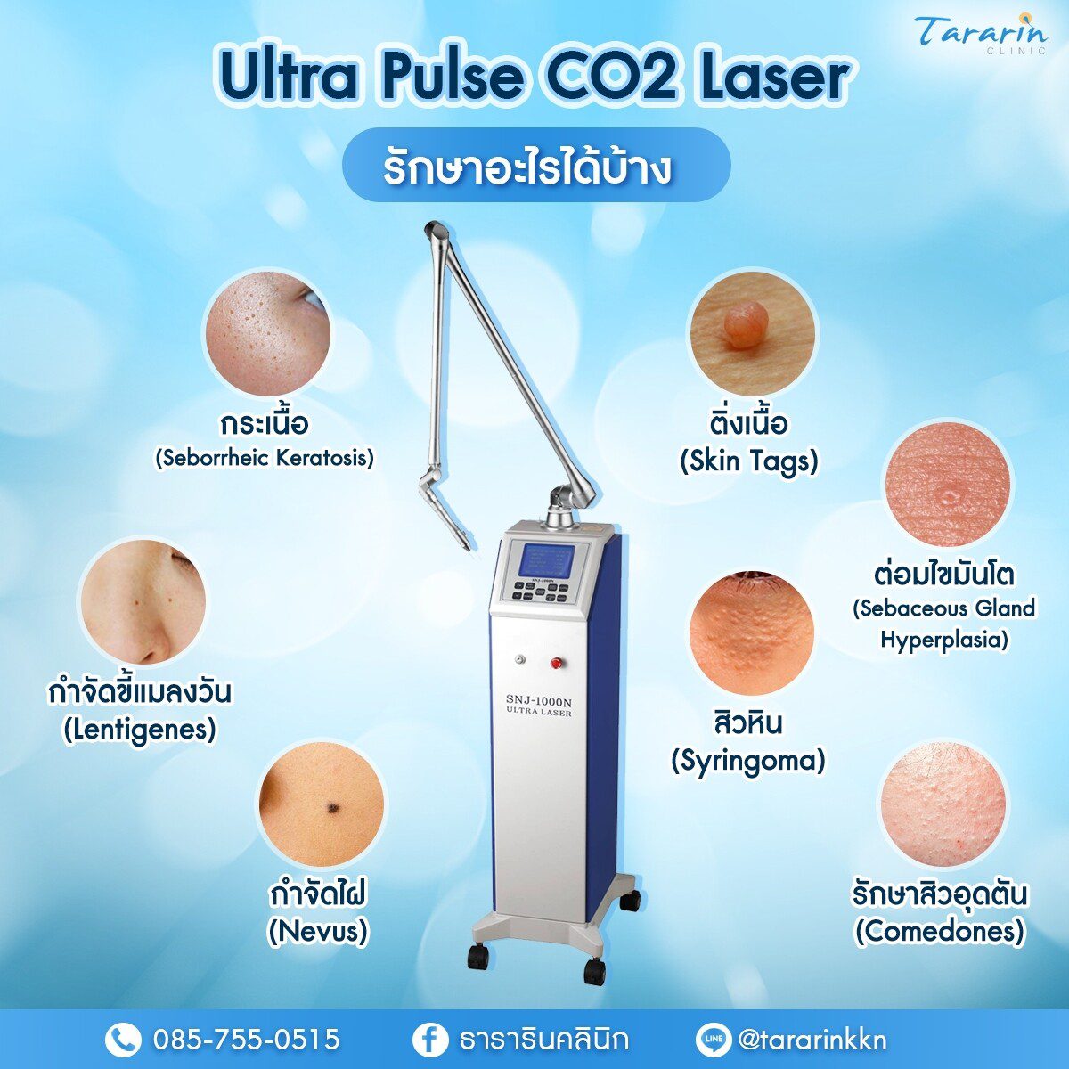 Ultra Pulse CO2 Laser รักษาอะไรได้บ้าง ?
