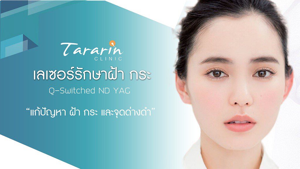 เลเซอร์ฝ้า กระ หน้าใส Q-Switched Nd Yag - Tararin Clinic