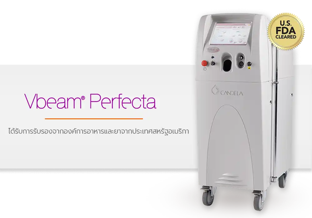 รู้จัก Vbeam Laser รุ่น Perfecta ท็อปใหม่ล่าสุด เทคโนโลยีที่รักษารอยโรคผิวหนังได้มากกว่า 20 ชนิด