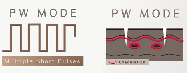 Pulse Wave Mode (PW)
